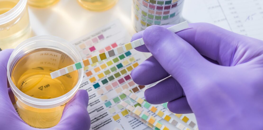 What Is a 10 Panel Drug Test in Background Checking?